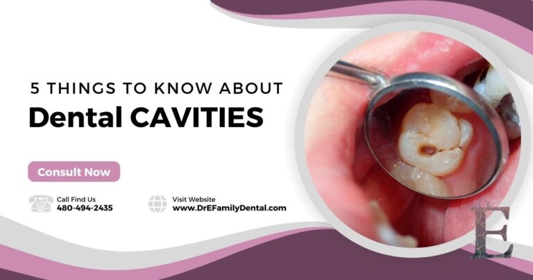 5 Things to Know About Cavities - Dr. E Dentistry