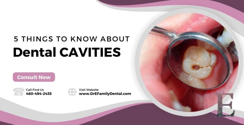 5 Things to Know About Cavities