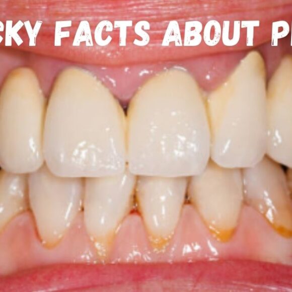 12 Sticky Facts About Plaque