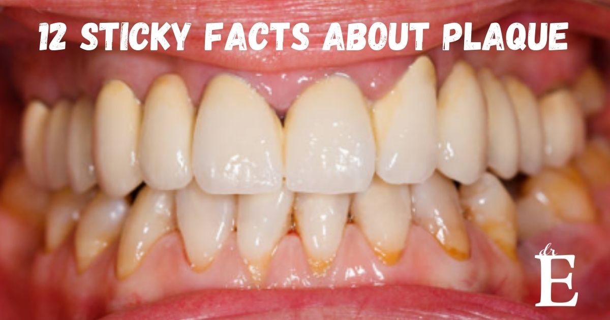 12 Sticky Facts About Plaque - Dr. E Dentistry