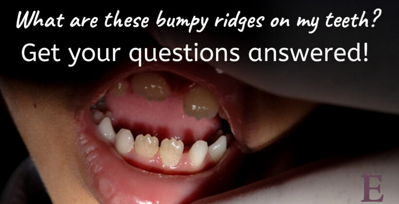 Five Common Questions About Your Teeth (and the Answers!)