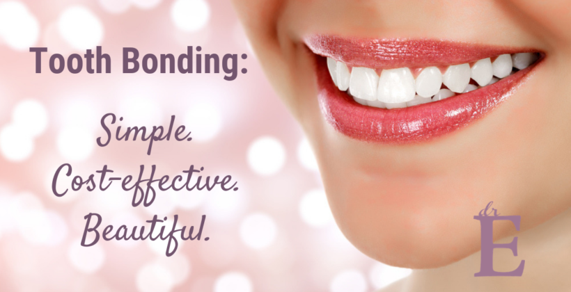 What is Tooth Bonding?