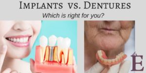 dental implants versus dentures image