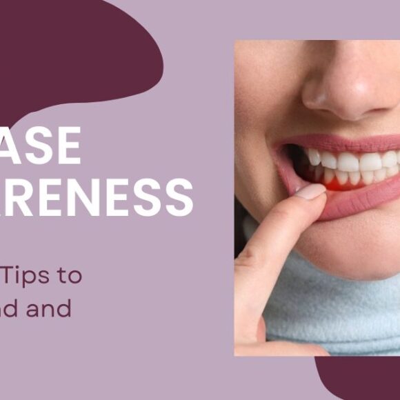Gum Disease Awareness Month: Facts and Tips