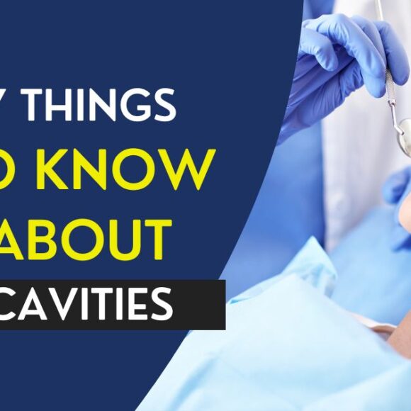 7 Things to Know About Cavities