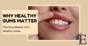 Healthy Gums Matter image of mouth showing gums
