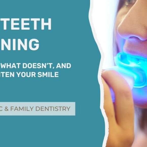 Home Teeth Whitening: What Works, What Doesn’t