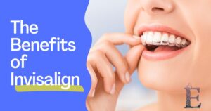 invisalign benefits