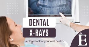 dental x-rays