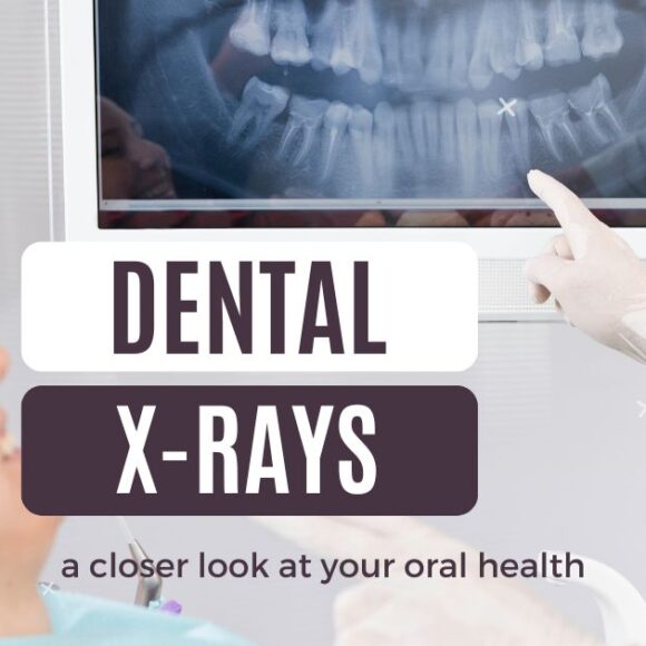 Dental X-Rays: A Closer Look at Your Oral Health