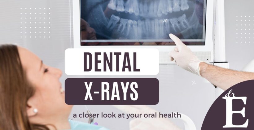 Dental X-Rays: A Closer Look at Your Oral Health